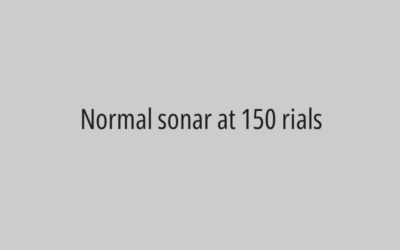 Normal sonar at 150 rials