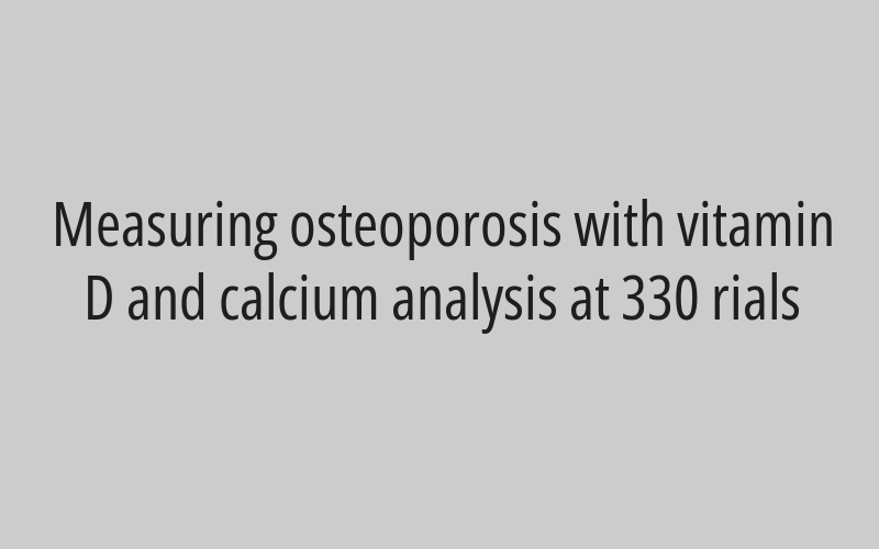 The FL laser with RTosh is three areas at 299 rials