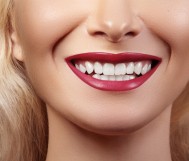 Hollywood smile (veneers) 16 years for 4900 riyals