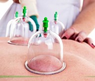 Therapeutic cupping