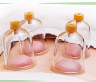 Protective cupping