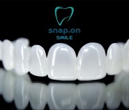 Snap on smile for jaws