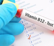 Vitamin B12 analysis