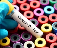 Vitamin D analysis