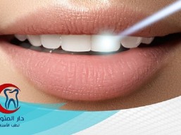 50% discount on taking off the milk tooth or baby fillings for 50 riyals