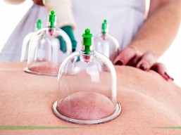 Therapeutic cupping