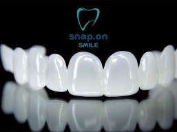 Snap on smile for jaws