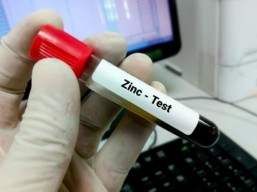 Zinc analysis