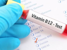 Vitamin B12 analysis