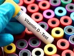 Vitamin D analysis