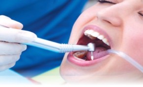 Cleaning teeth for 190 riyals and get the same service for another person for free