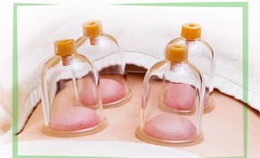 Protective cupping