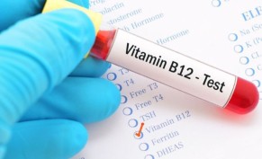 Vitamin B12 analysis