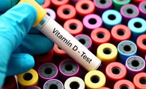 Vitamin D analysis