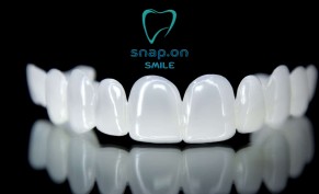 سناب اون سمايل للفكين