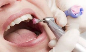 Teeth cleaning and lime removal + treatment plan for 129 riyals