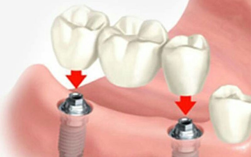 Crystal Dental Complex