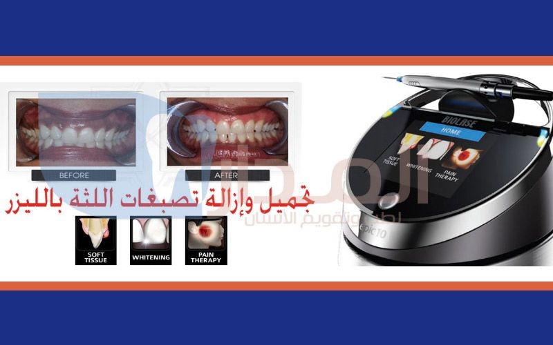 Al-Madar Dental Clinics (Al-Rawda)