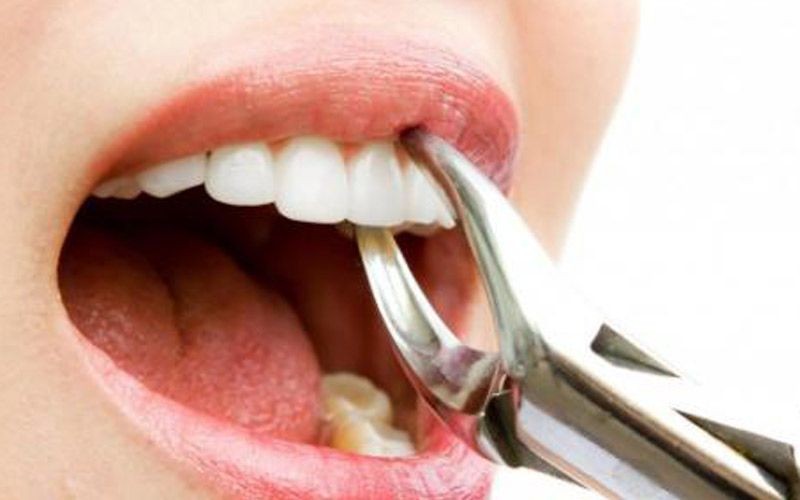 Al-Madar Dental Clinics (Al-Shifa)