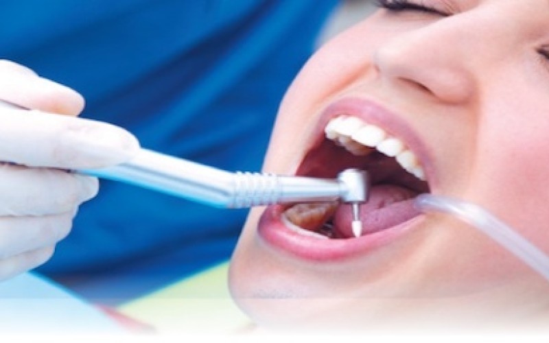 Cleaning teeth for 190 riyals and get the same service for another person for free