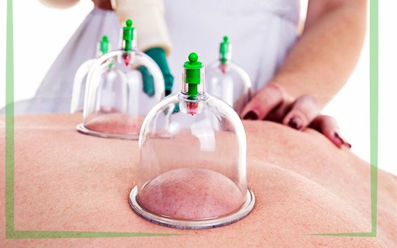 Therapeutic cupping