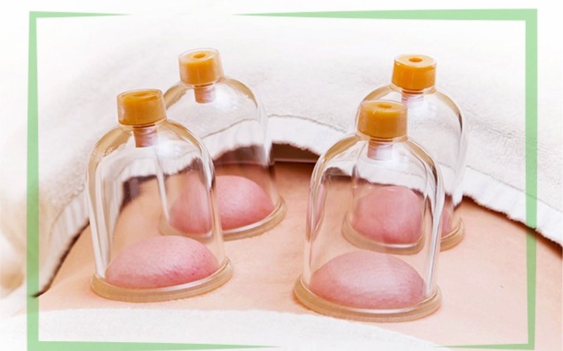 Protective cupping