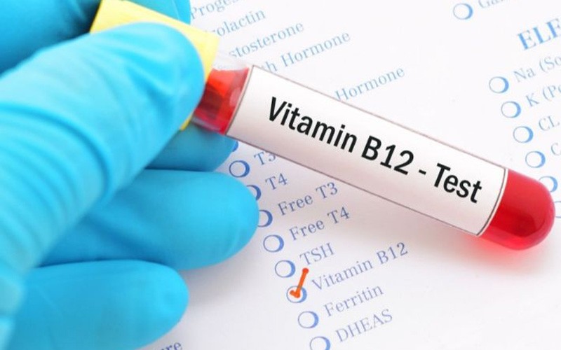 Vitamin B12 analysis