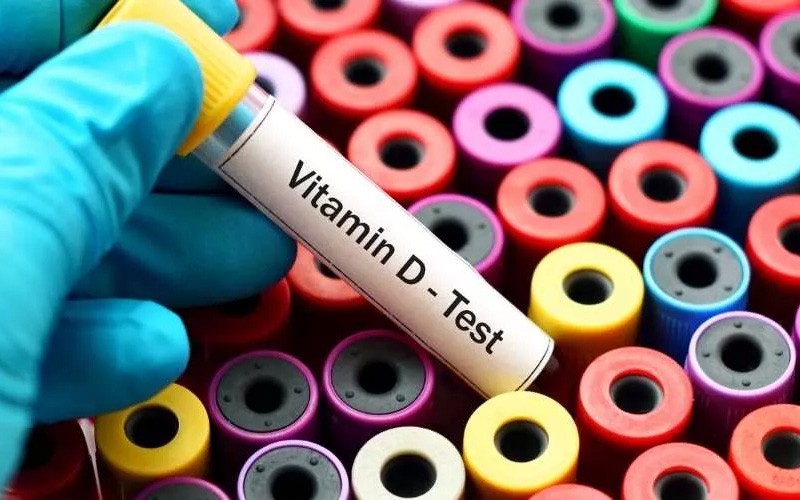 Vitamin D analysis