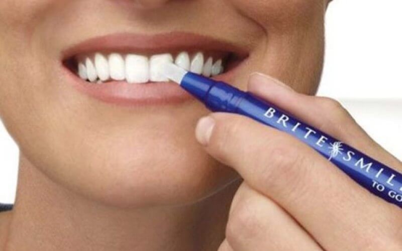 خصم 40% على تبييض الأسنان